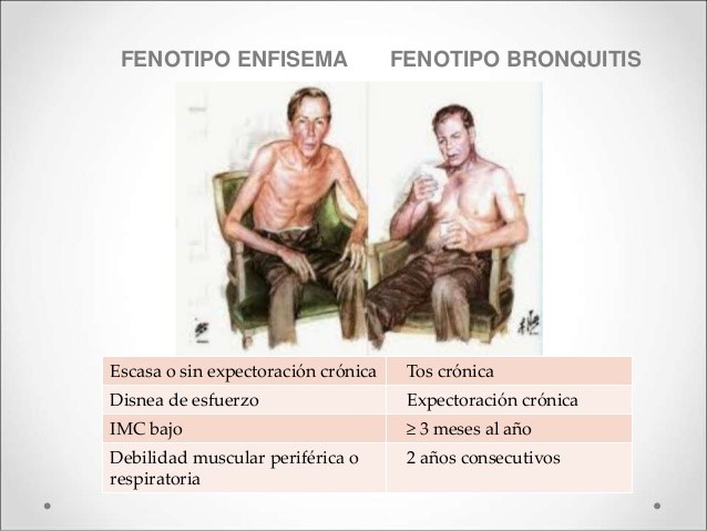 La Enfermedad Pulmonar Obstructiva Crónica Epoc Fisioterapia